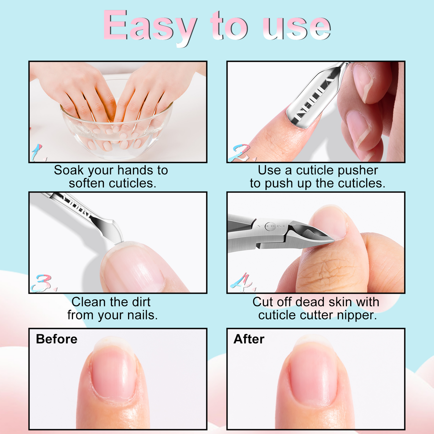 Cuticle Remover Kit 4Pcs